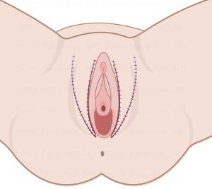 Picture4