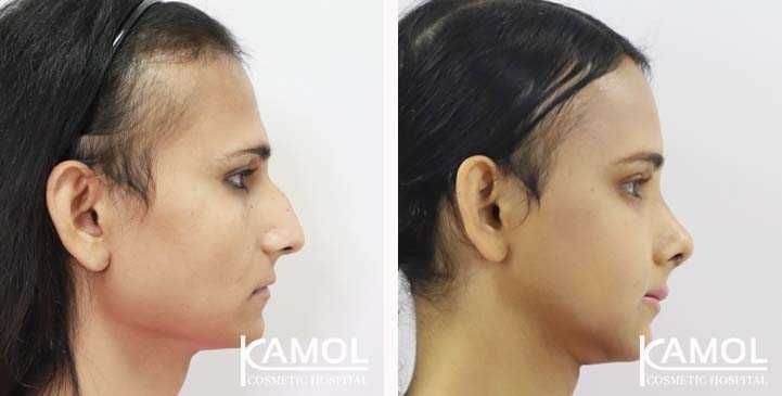 Cirurgia de Feminização Facial / FFS 18 lg 649495899530b image