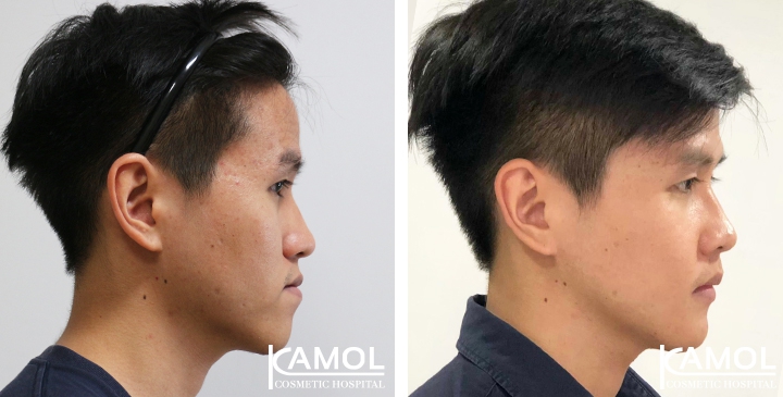 Corrective Jaw Surgery 10 lg 6494958fe2fdd image