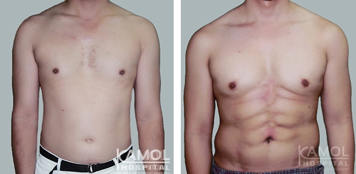 การทำหน้าท้องซิกซ์แพ็ค 14 lg 6494959c53964 image
