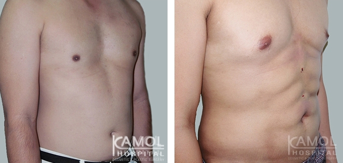 การทำหน้าท้องซิกซ์แพ็ค 16 lg 6494959c5582d image