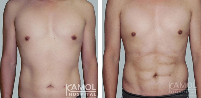การทำหน้าท้องซิกซ์แพ็ค 18 lg 6494959c5a48c image