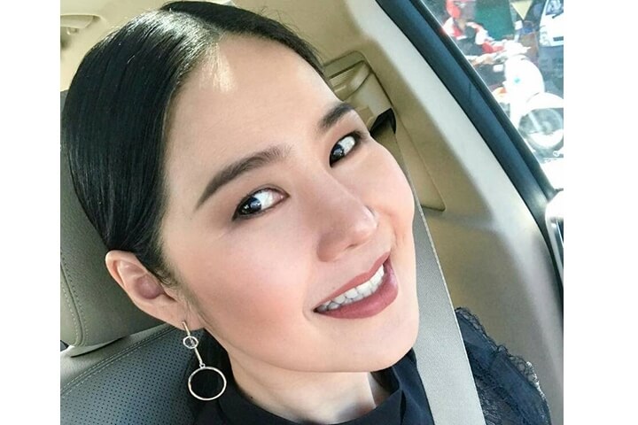 تقليل عظام الوجنة / تقليل عظم الوجنة 16 lg 649f889595966 image