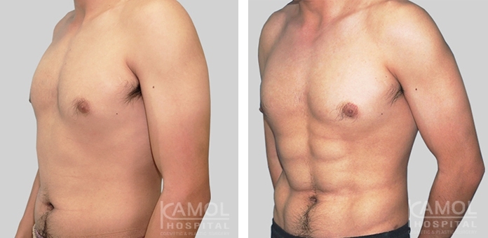 Chirurgie Six Pack 8 lg 649f895111804 image