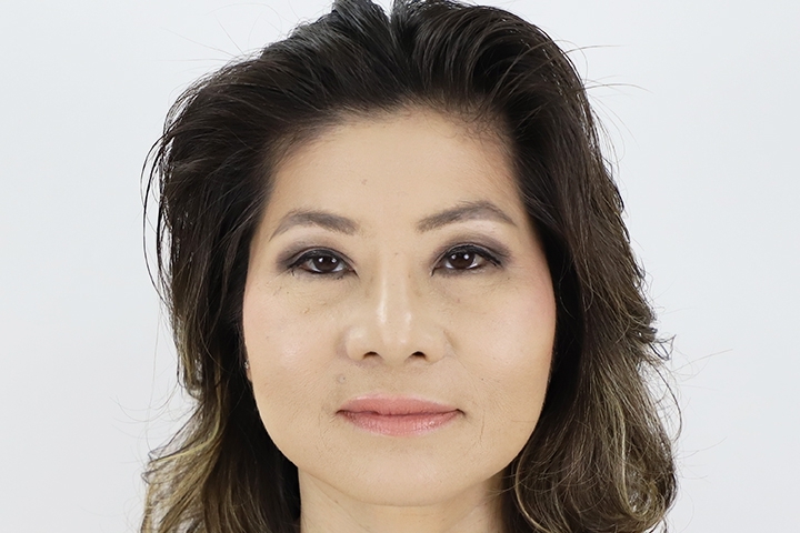 تجميل الجفون / جراحة الجفون 23 lg 6523d04b868a2 image