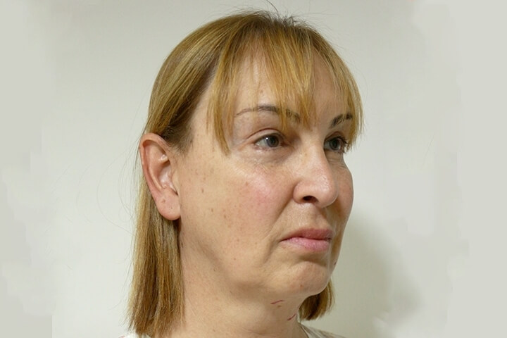 شد الوجه / شد الرقبة 11 lg 652c94967c8d9 image