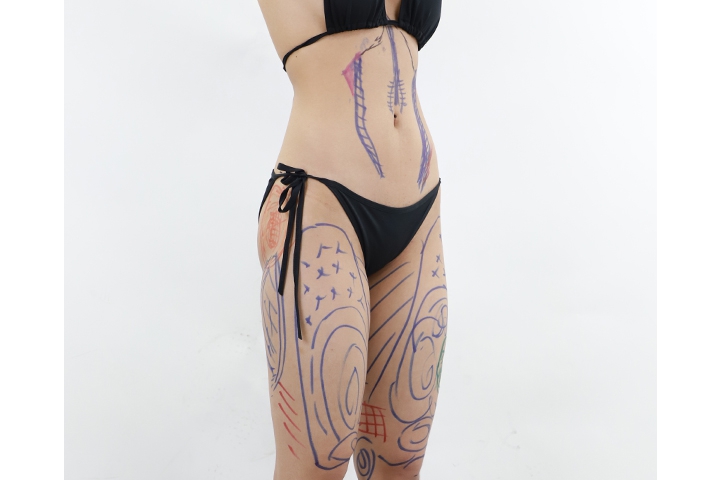 How to get ready for liposuction 3 lg 649980b506b15 image 1 1