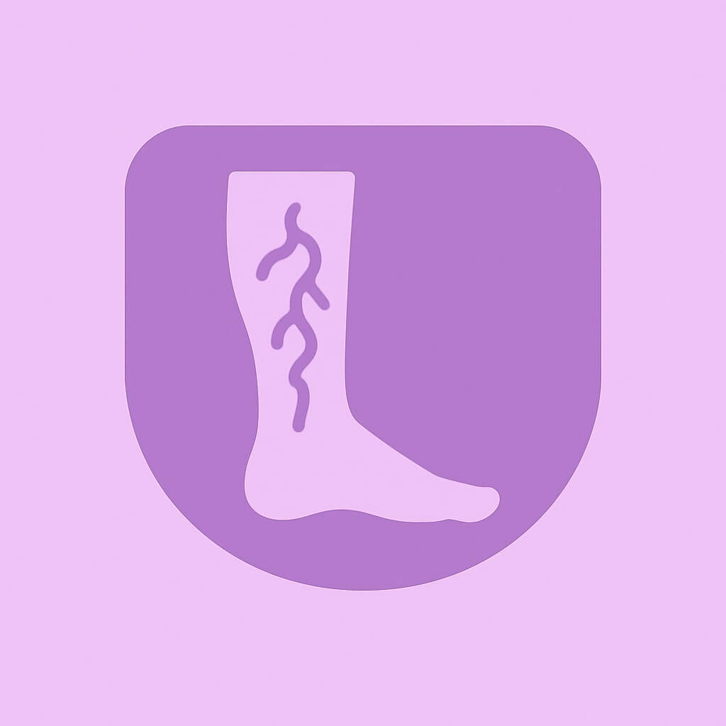Varicose Veins min